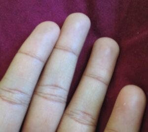 Fingerprint