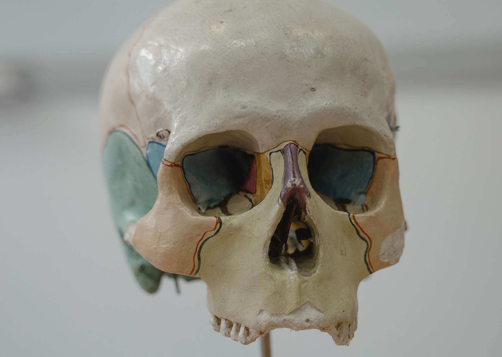 Facial Reconstruction-An Essential Tool in Criminalistics